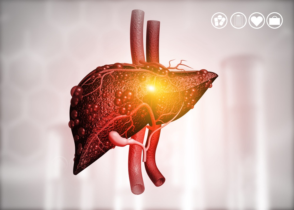 Diseased,Human,Liver,On,Science,Background.,3d,Illustration